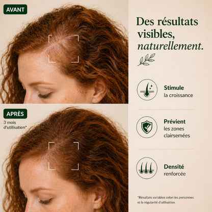 Sérum Capillaire Bio au Romarin – Pousse & Anti-Chute